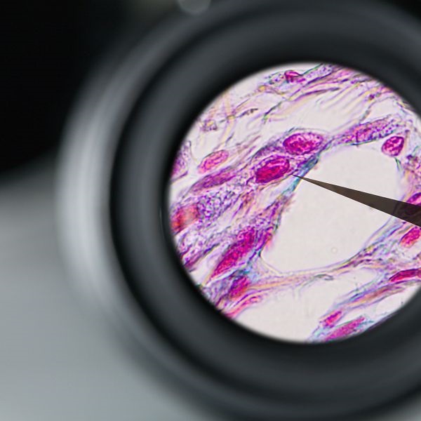 Eyepiece WF 10x/22 Br. foc. with pointer for Primostar 3